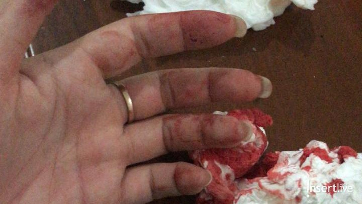 Foto Bukti KDRT Aska Ongi