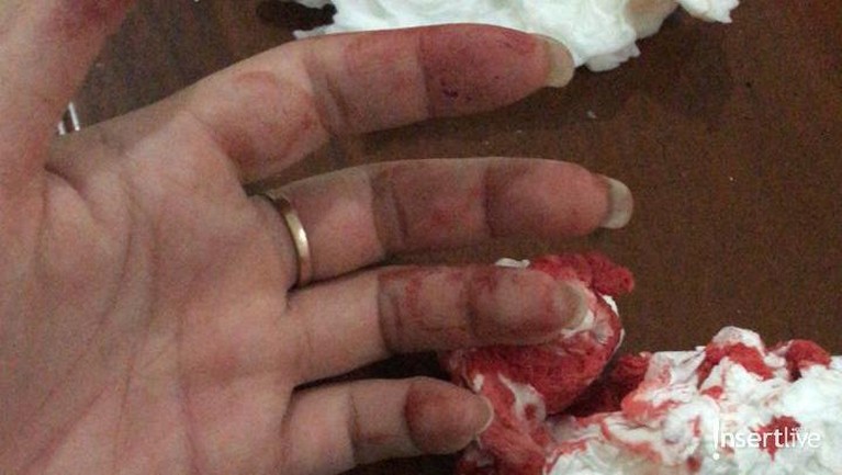 Foto Bukti KDRT Aska Ongi Foto Bukti KDRT Aska Ongi