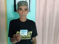 Dijamin JKN-KIS, Operasi Kepala Sidik Gratis
