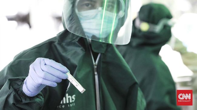 SWAB TEST COVID 19 PT Bank Negara Indonesia (Persero) Tbk (Bank BNI) berkolaborasi dengan jaringan Rumah Sakit Bunda dan JSK Group menggelar swab test Covid-19 secara gratis untuk 30.000 orang di area parkir selatan GBK, Jakarta, Kamis (21/5/2020). CNN Indonesia/Andry Novelino