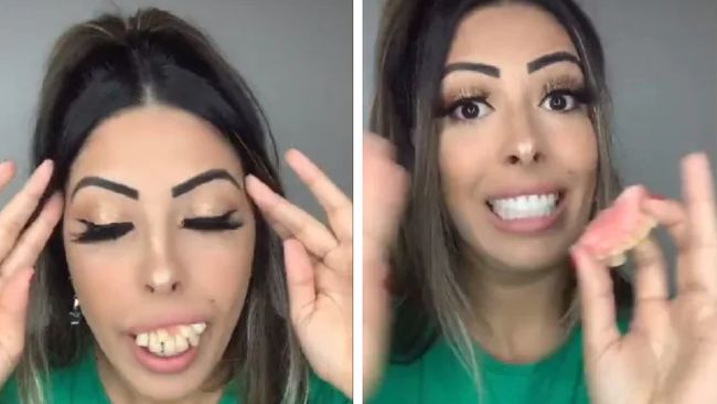 Viral Wanita Bergigi Berantakan Berubah Cantik, Faktanya Bikin Emosi
