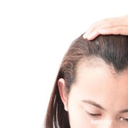 Rambut Bagian Depan Rontok Hingga Garis Rambut Mulai Tipis? Duh, Waspadai Penyebabnya!
