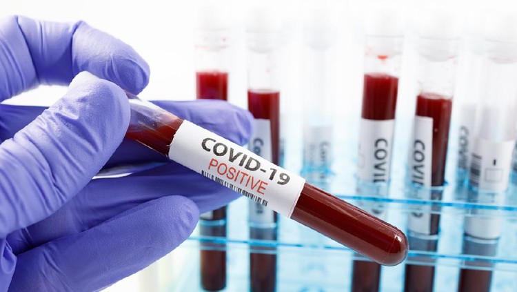 Close up of microbiologist hand with surgical gloves holding a positive blood test result for coronavirus. Test tubes rack with blood sample for covid-19 virus, on white background with copy space.