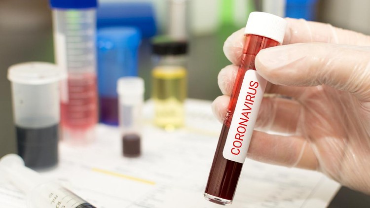 Concept to represent the 2020 virus threat Coronavirus, blood in a test tube.
