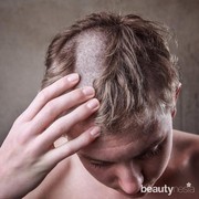 Salah Cukur Sampai Jadi Pitak? Begini Cara Mengatasinya