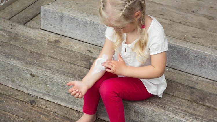 Girl applying cream on allergic skin, eczema treatment.
