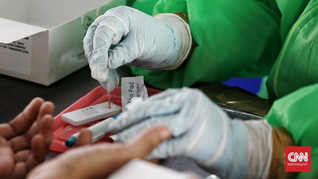 Rapid Test gratis untuk masyarakat DKI Jakarta di terowongan Kendal, Jakarta Pusat.  Senin (8/6/2020). Rapit test ini diadakan oleh petugas medis dari warna warni media dan home care yang merupakan bagian dari gugus tugas BNPB. CNN Indonesia/Andry Novelino