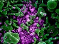 VIDEO: Virus Corona Lebih Berisiko pada Penderita Hipertensi
