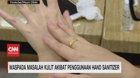 VIDEO: Waspada Masalah Kulit Akibat Penggunaan Hand Sanitizer