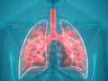 Infeksi Pneumonia, Kadis Pemkot Surabaya Meninggal Dunia