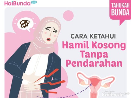 Cara Ketahui Hamil Kosong Tanpa Pendarahan