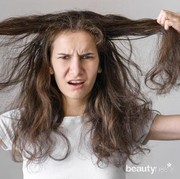 Kulit Kepala Gatal? Coba Atasi dengan 5 Cara Mudah Ini