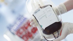 Thalassemia dan Perjuangan Mencari Darah di Tengah Pandemi