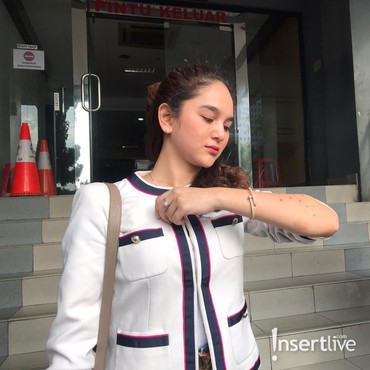 Tertekan karena Dianiaya, Hana Hanifah Datangi Psikiater