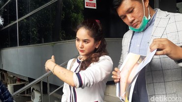 Pengacara Hana Hanifah Benarkan Kliennya Diperiksa di Polrestabes Medan