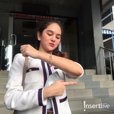 Hana Hanifah Bocorkan Tarif Artis dalam Prostitusi Online