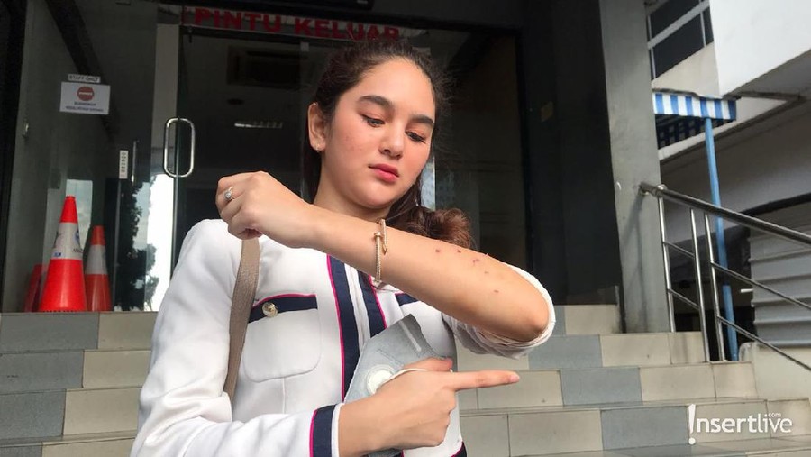 Hana Hanifah