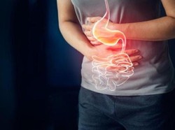 Penyakit Asam Lambung Sebabkan Masalah Serius, Begini Mengatasinya