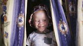 Albino di Zimbabwe Tendai Mandizha smiles behind a curtan at their family home in Chitungwiza on the outskirts of Harare, in this Tuesday, June, 9, 2020 photo. Mandizha is one of Joyce Muchenje's three children, who all have albinism. Muchenje used to provide for them by washing laundry and household cleaning for cross border traders at a busy border town before the lockdown, but now the border trade has stopped and Mutenje has run out of money to get the skin cream for her children. (AP Photo/Tsvangirayi Mukwazhi)