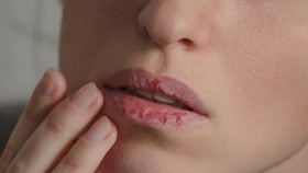Aplikasi Covid Inggris Sebut Bibir Kering Jadi Gejala Corona