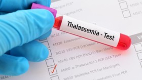 Jangan Abaikan Deteksi Dini untuk Hadapi Thalasemia