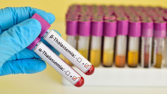Thalasemia merupakan kelainan darah yang ditandai oleh kurangnya protein pembawa oksigen (hemoglobin) dan jumlah sel darah merah yang kurang dari normal.