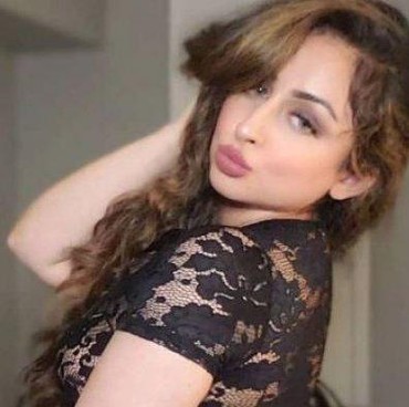 Ingin Bokong Seperti Kim Kardashian, Wanita Ini Tak Bisa Duduk Berbulan-bulan