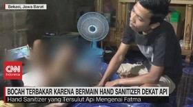 VIDEO: Bocah Terbakar Karena Bermain Hand Sanitizer
