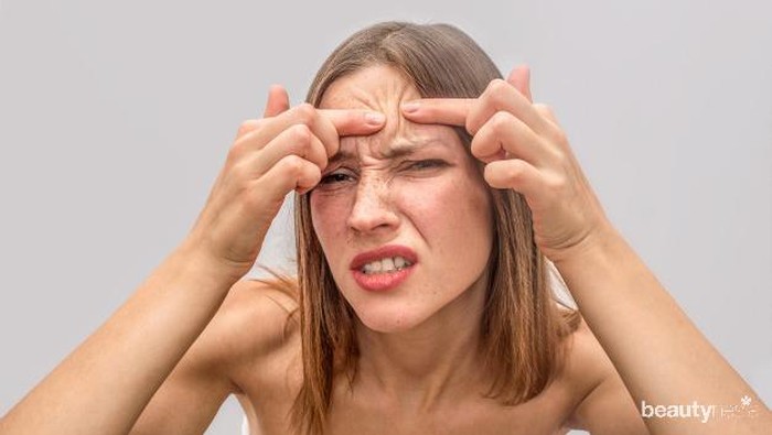 Timbul Rasa Gatal Pada Jerawat? Ternyata Ini Penyebabnya