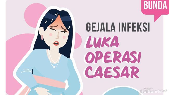 Gejala Infeksi Luka Operasi Caesar