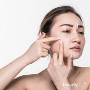 Hilangkan Bekas Jerawat dengan Konsumsi 7 Makanan Ini