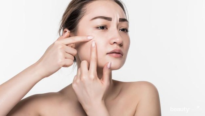 Hilangkan Bekas Jerawat dengan Konsumsi 7 Makanan Ini