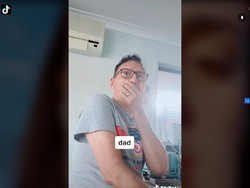 Perawatan Hilangkan Double Chin, Wajah Wanita Ini Malah Bikin Syok Keluarga
