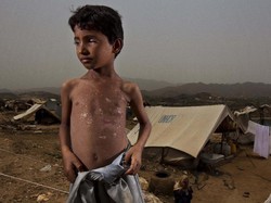Serangan Udara di Yaman Tewaskan 5 Anak, Houthi Salahkan Arab Saudi
