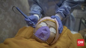 FOTO : Melongok Protokol Kesehatan di Klinik Kecantikan