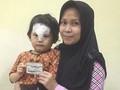 Terbukti Melindungi, Ferlys Percayakan JKN-KIS untuk Anak