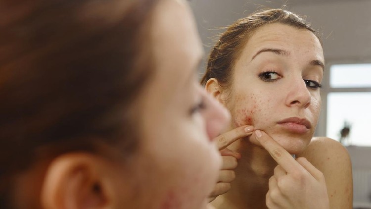 teenager portrait with acne looking in the mirror.