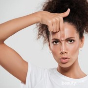 5 Cara Mudah Mengatasi Kulit Wajah Berminyak