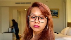 Penampilan Terbaru Cimoy Montok, Makin Glowing hingga Disebut Mirip Lesti