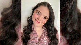 Ellie, Model Down Syndrome Jadi Model Vogue dan Gucci Beauty