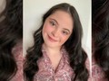 Ellie, Model Down Syndrome Jadi Model Vogue dan Gucci Beauty
