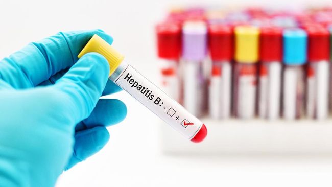 Kenali Jalur Penularan Hepatitis B