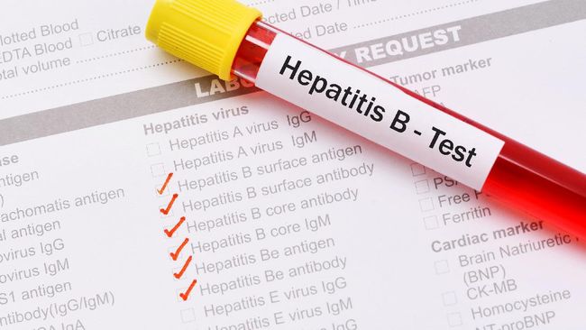 Hari Hepatitis Sedunia atau World Hepatitis Day kembali diperingati pada hari ini 28 Juli 2021 dengan mengusung tema Hepatitis Can't Wait.
