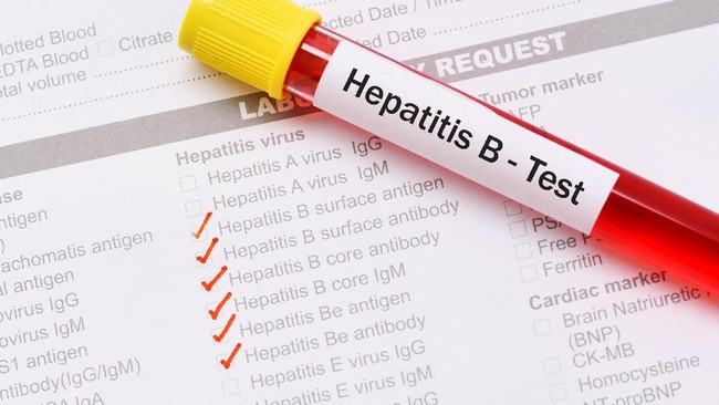 Kementerian Kesehatan (Kemenkes) menyebut 35.757 bayi hepatitis B lahir dari ibu yang positif hepatitis B.