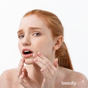 Pori-pori Wajah Tersumbat? Jangan Khawatir Atasi dengan Bahan Alami Ini