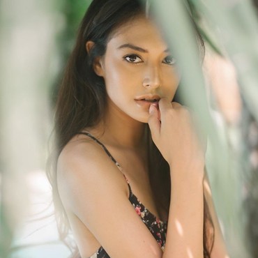 Aurelie Moeremans Lawan Tumor Colli, Wajah Sampai Kaku 6 Bulan