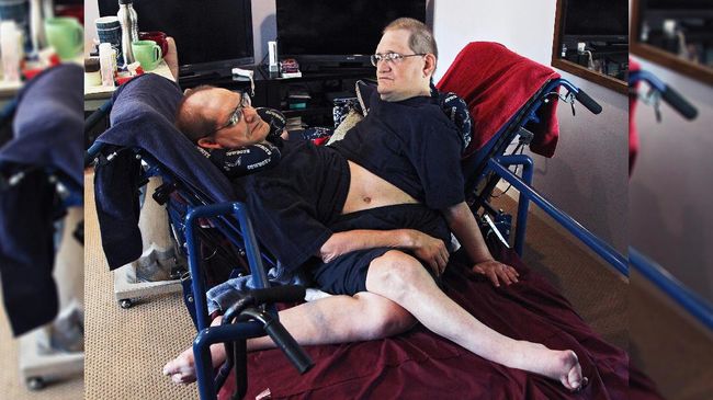 FILE - Donnie, left, and Ronnie Galyon sit inside their Beavercreek, Ohio, home, in a Wednesday, July 2, 2014 file photo. The world’s longest surviving conjoined twins died on July 4, 2020 at the age of 68. Ronnie and Donnie Galyon of Beavercreek, Ohio were born joined at the abdomen. In 2014, earned the distinction of being the world’s oldest set of conjoined twins shortly before their 63rd birthday. (Drew Simon/Dayton Daily News via AP, File)