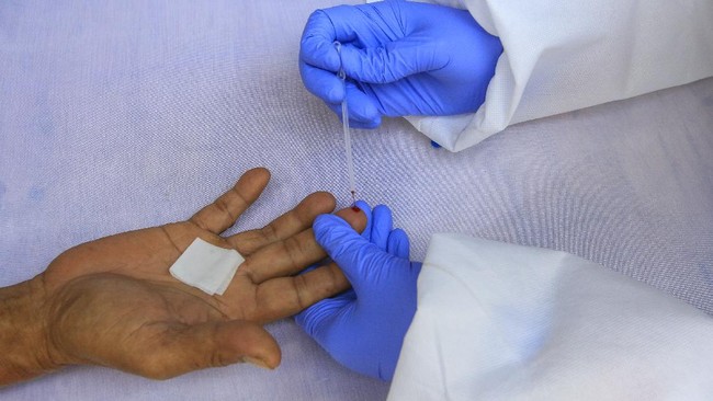 BPK menemukan dua pengadaan rapid test covid-19 dengan merek serupa dan waktu berdekatan, namun beda harga. Sehingga terjadi pemborosan Rp1,1 miliar.