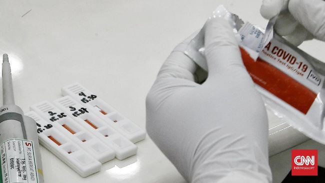 Rapid Tes Corona RI-GHA Covid 19 Petugas kesehatan menggunakan alat rapid diagnostic test Corona RI-GHA COVID-19 di ruang Heritage, Kemenko PMK, Jakarta. Kamis (9/7/2020). CNN Indonesia/Andry Novelino