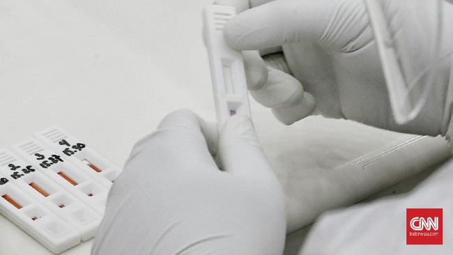Dinkes DKI Jakarta menyebut total kasus positif virus corona di ibu kota mencapai 27.863 kasus setelah bertambah 621 kasus dari hari kemarin.